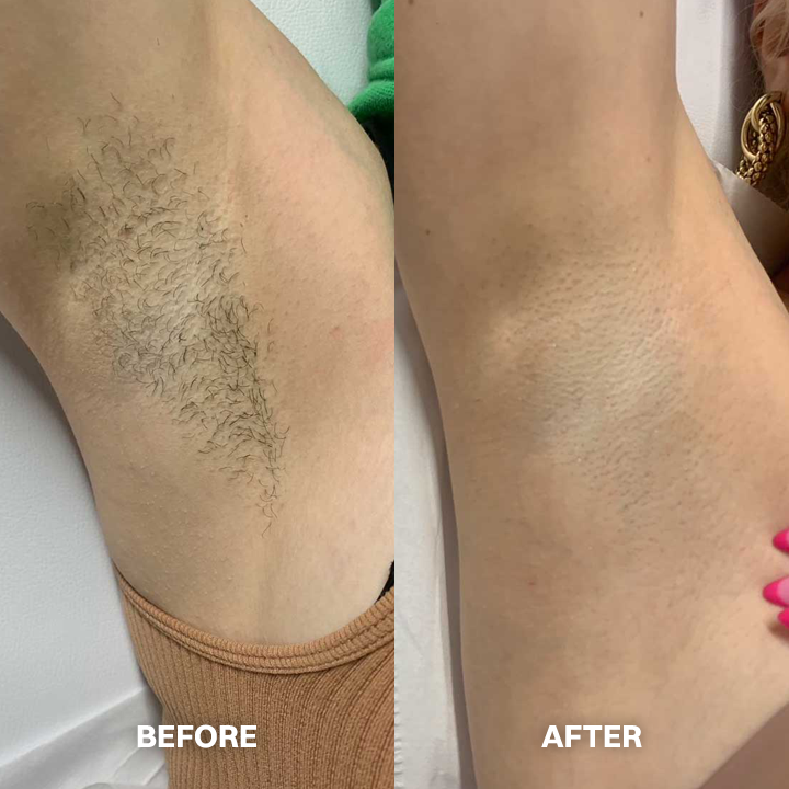 Vigorcurve® Body Hair Removal Cream for All Women & Men