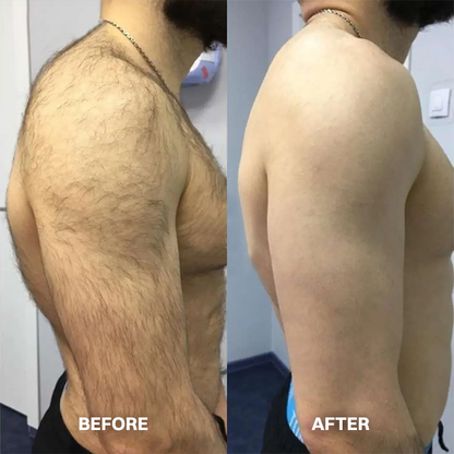 Vigorcurve® Body Hair Removal Cream for All Women & Men
