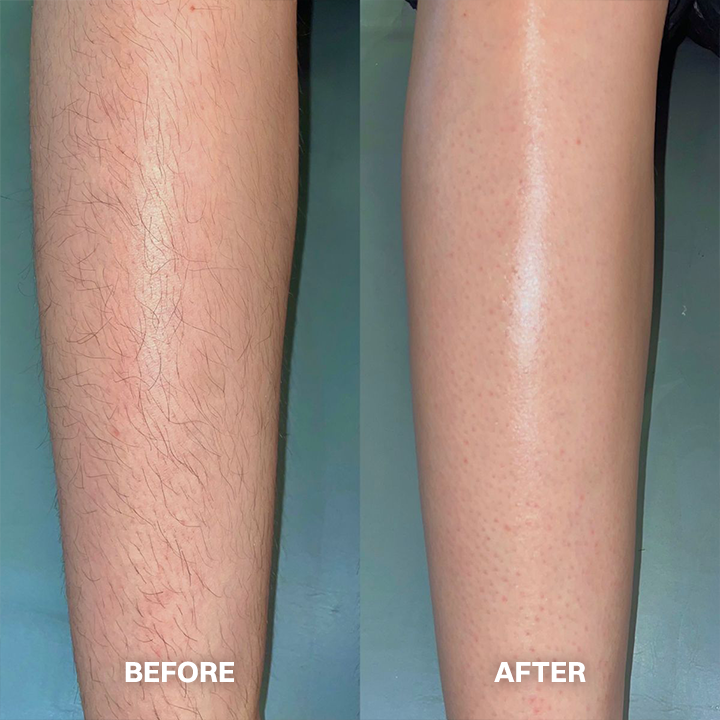 Vigorcurve® Body Hair Removal Cream for All Women & Men