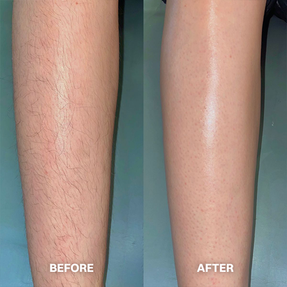 Vigorcurve® Body Hair Removal Cream for All Women & Men
