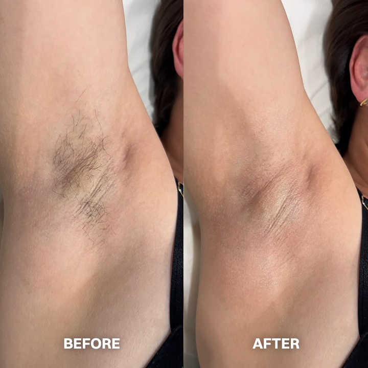 Vigorcurve® Body Hair Removal Cream for All Women & Men
